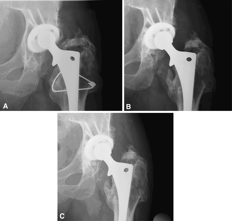 Fig. 2A–C