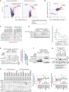 Figure 6. Ubiquitination and stability of HRI are governed by the BIRC6 complex. A, Proteomic changes following BIRC6 depletion in the presence and absence of ISRIB. HCC202-Cas9 cells were transduced with either a control sgRNA (sgCh2–2) or an sgRNA targeting BIRC6 (sgBIRC6–4). Four days later, cells were harvested and subjected to LC/MS-MS. The magnitude [LFC (sgBIRC6/sgCh2–2)] and significance [−log10 (P)] of the difference in protein expression between the control and BIRC6 knockout samples were plotted. Here and in B, the products of the genes that are transcriptionally regulated by ISR are indicated by the orange dots, while HRI is indicated by the green dot. B, Comparison of the BIRC6-depletion-induced proteomic changes in the presence and absence of ISRIB treatment. C, Elevated expression of HRI protein after depleting individual components of the BIRC6 complex. HCC202-Cas9 and SNU503-Cas9 cells were transduced with the indicated sgRNA, and their lysates were harvested 4 days later. Lysates of the cells treated with MG-132 (10 μmol/L) or a vehicle control for 6 hours were also analyzed by immunoblotting. D, Stabilization of HRI following BIRC6 depletion. HCC202-Cas9 cells, transduced with either sgCh2–2 or sgBIRC6–4, were transiently transfected with a plasmid expressing V5-tagged HRI (HRI-V5). These cells were subsequently treated with cycloheximide (CHX, 50 μg/mL) and harvested at the indicated time points. Changes in the relative intensity between V5 and β-actin signals were plotted (right). Values = means ± SEM (n = 4). ****,P < 0.0001. E, Reduced HRI ubiquitination following BIRC6 depletion. HCC202-Cas9 cells that constitutively express HA-tagged ubiquitin (HA-ubiquitin) were further engineered to express HRI-V5 in a doxycycline-inducible manner and then transduced with sgCh2–2 or sgBIRC6–4. These cells were subsequently treated with doxycycline (1 μg/mL, 48 hours), ISRIB (1 μmol/L, 48 hours), and/or MG-132 (10 μmol/L, 6 hours) and their lysates were immunoprecipitated with anti-V5 followed by immunoblotting. The ubiquitin chains attached to HRI-V5 were clearly detected in the control (sgCh2–2) sample treated with all the three reagents (DOX, ISRIB, MG-132), but was less clear in the BIRC6 KO (sgBIRC6–4) sample. The relative intensity between HA(-ubiquitin) and (HRI-)V5 signals for the samples cotreated with doxycycline, ISRIB, and MG-132 was plotted (right). Values = means ± SD (n = 5). F, A physical interaction between UBR4 and HRI. HCC202-Cas9 cells were engineered to express HRI-V5 in a doxycycline-inducible manner. Following treatment with doxycycline (1 μg/mL, 48 hours), ISRIB (1 μmol/L, 48 hours), and/or MG-132 (10 μmol/L, 6 hours), cells were harvested, and the lysates were subjected to anti-V5 immunoprecipitation and analysis by immunoblotting. G, Analysis of HRI phosphorylation status using a Phos-tag gel. HCC202-Cas9 cells, transduced with either sgCh2–2 or sgBIRC6–4, were transiently transfected with a plasmid expressing HRI-V5. HCC202-Cas9 cells without sgRNA transduction were also transfected with an HRI-V5—expressing plasmid and subsequently treated with either arsenite (300 μmol/L, 3 hours) or vehicle control (mock). Lysates of these cells were either treated with lambda phosphatase (+λPP) or left untreated (+λPP) and analyzed by immunoblotting using a Phos-tag gel and a standard protein (regular) gel. The knockout of BIRC6 resulted in the upregulation of phosphorylated and nonphosphorylated forms of HRI. H, Changes in expression of ISR markers upon HRI depletion. The Cas9-expressing derivatives of the indicated cells were transduced with either an sgRNA against HRI or a control sgRNA (sgCh2–2). Four days later, their lysates were harvested and analyzed for the expression levels of various ISR marker proteins. Relative intensity of the ATF3 and SESN2 bands, both of which were normalized to the intensity of the corresponding β-actin band, between sgCh2–2 and sgHRI samples were plotted. Values = means ± SD (n = 3). ****,P < 0.0001 (dependent vs. nondependent). All the experiments were performed twice, except for the proteomics experiment (A and B; conducted once), cycloheximide-chase assay (D; summary of four independent experiments is presented), and HRI ubiquitination assay (E; summary of five independent experiments is presented).