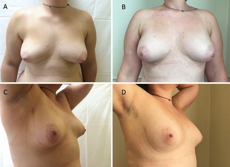 Fig. 4