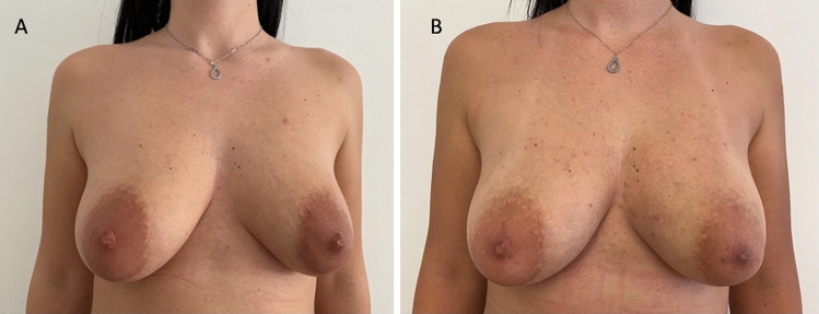 Fig. 7