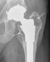 Fig. 4