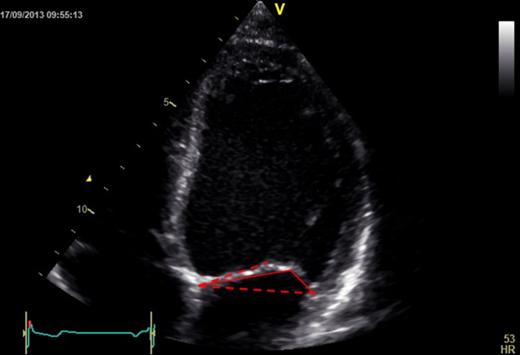 Figure 13