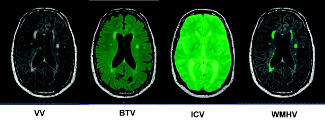 Fig 1.