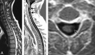 Fig 3.