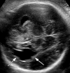 Figure 2a:
