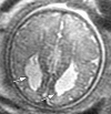 Figure 2b: