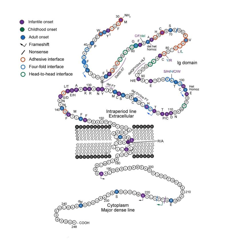 Genotype–phenotype characteristics and baseline natural history of ...