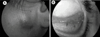 Fig 5