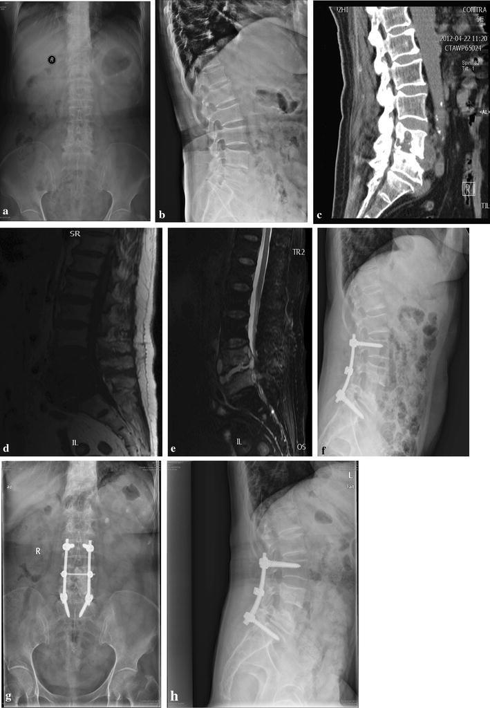 Fig. 1