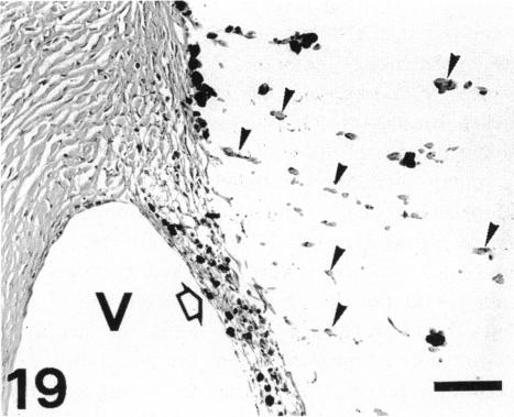 Fig. 19