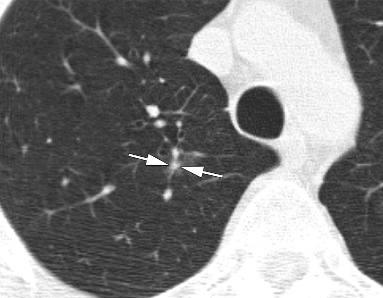 Figure 3c: