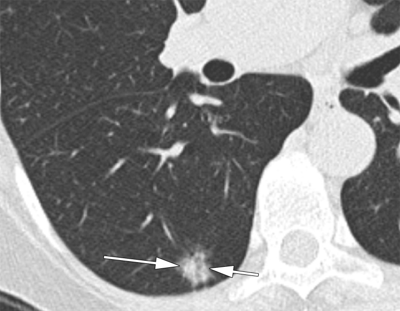 Figure 4b: