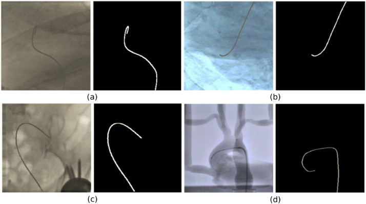 Fig. 2