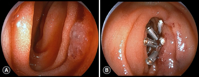 Fig. 4.