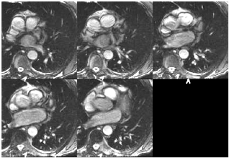 Fig. (4)