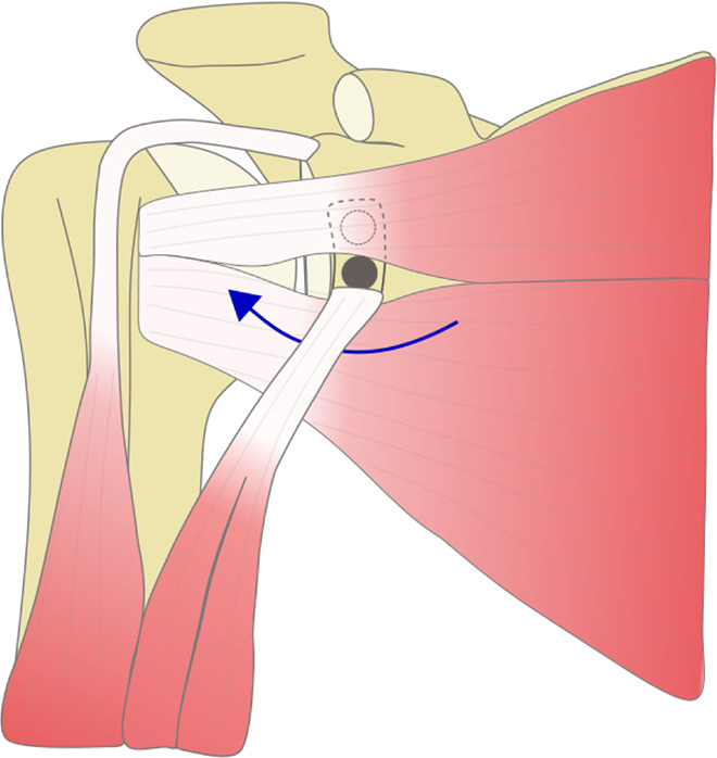 Figure 10.