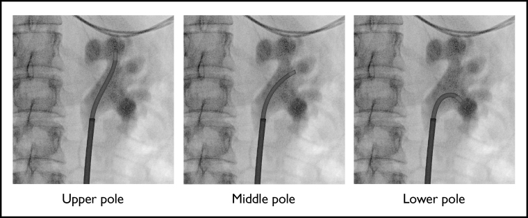 FIG. 2.