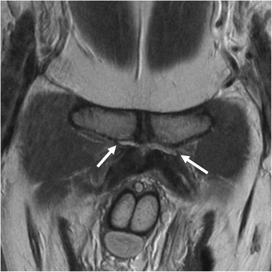 Fig. 13