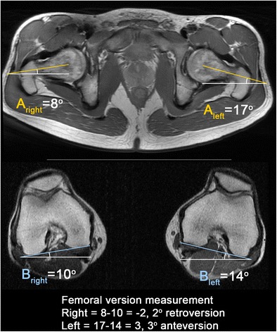 Fig. 11