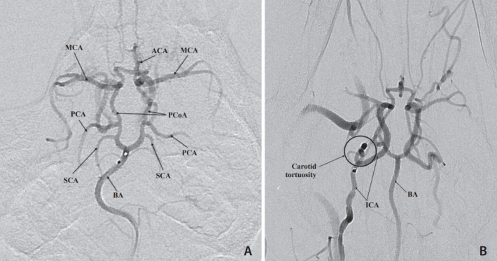 Fig. 3.