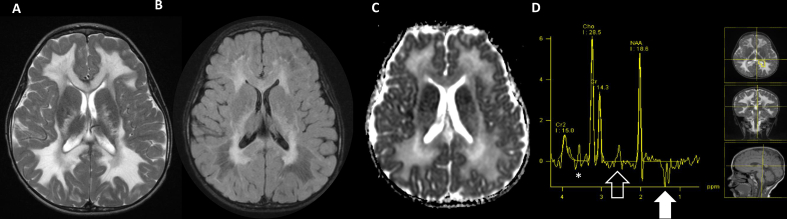 Fig. 2