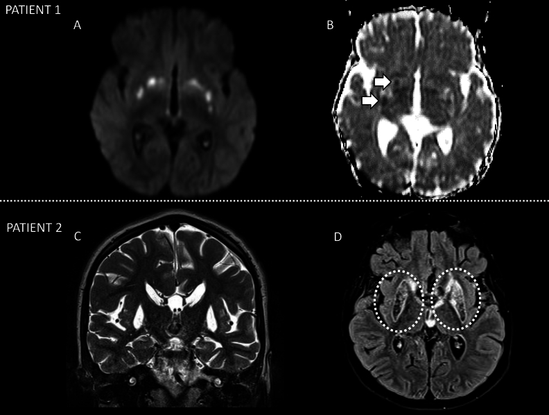 Fig. 1