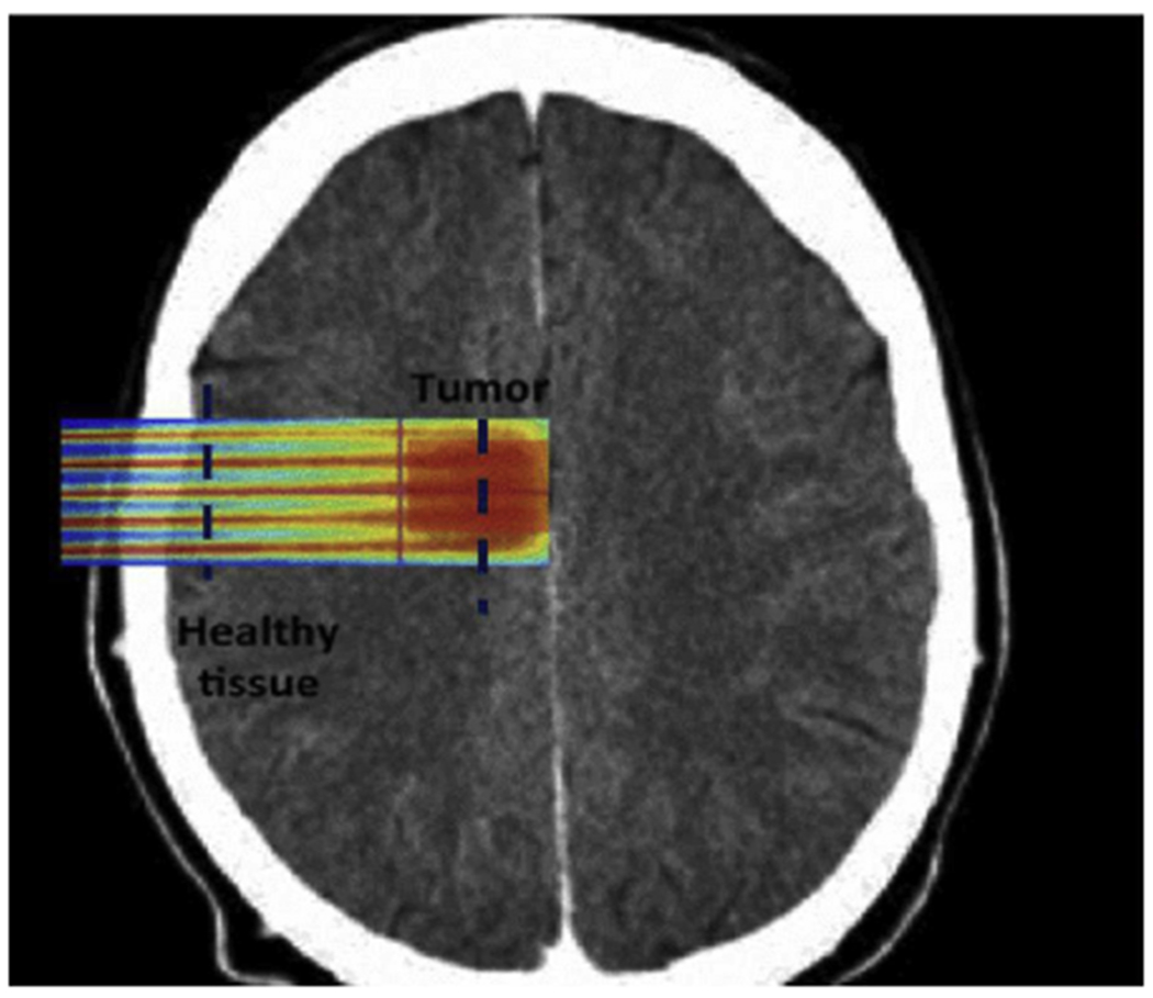 Fig. 6.