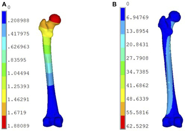 Biomechanics of PHILOS plates in Vancouver B1 periprosthetic femoral ...