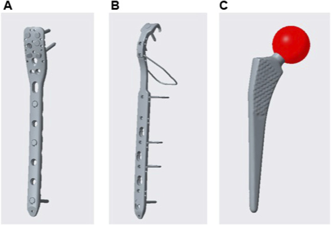 Biomechanics of PHILOS plates in Vancouver B1 periprosthetic femoral ...