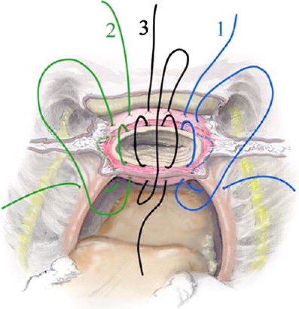 Fig. 6