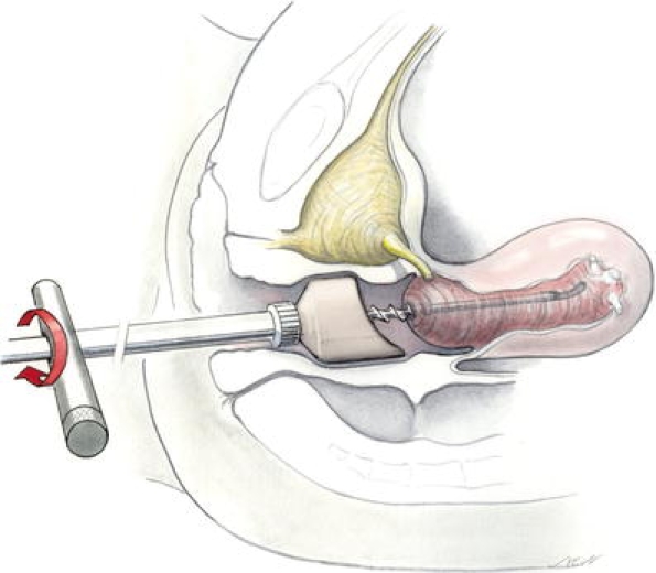 Fig. 2