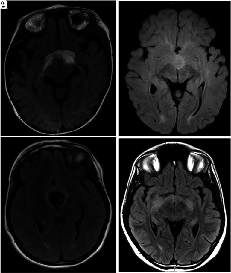 FIG 2.