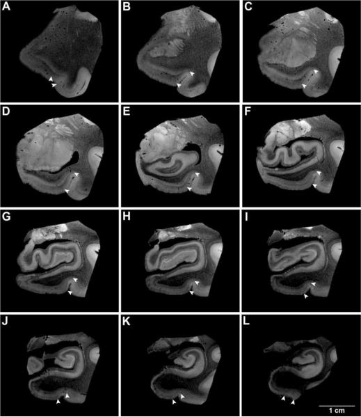 Predicting the Location of Human Perirhinal Cortex, Brodmann's area 35 ...