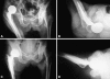 Fig. 2A–D