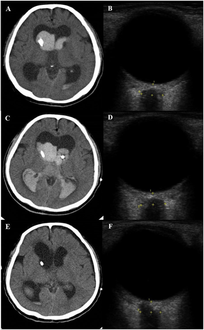 Fig 3