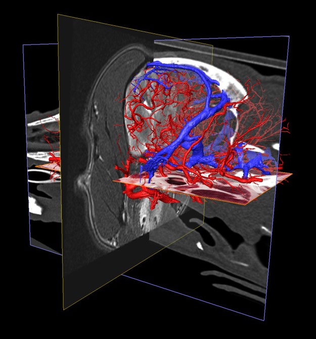 Fig 14