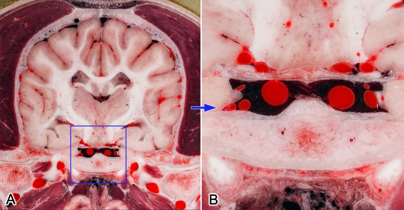 Fig 4