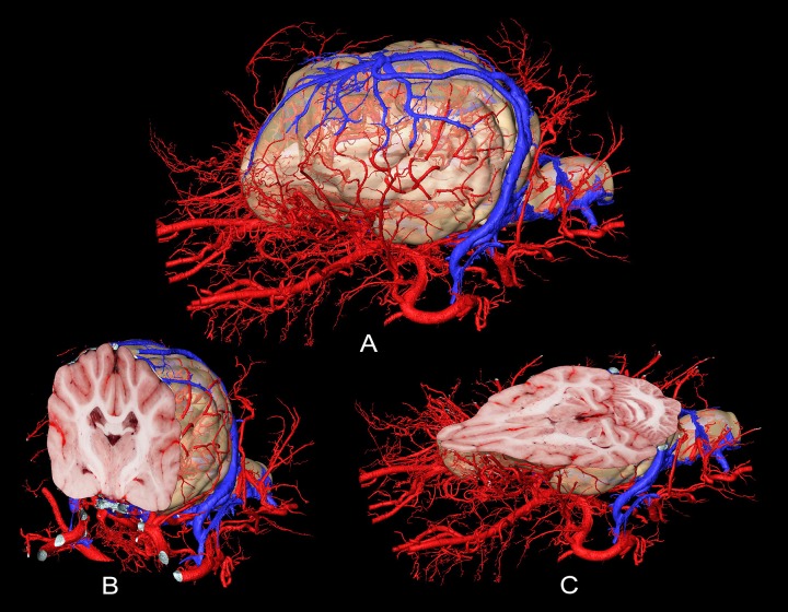 Fig 15