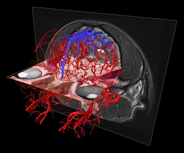 Fig 13