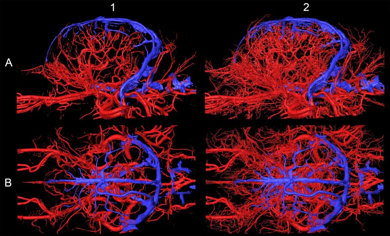 Fig 11