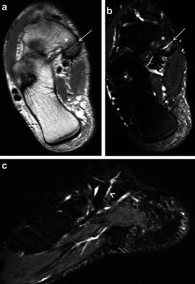 Fig. 19