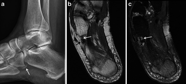 Fig. 18