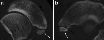 Fig. 15