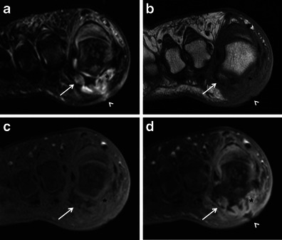 Fig. 13