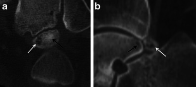 Fig. 16