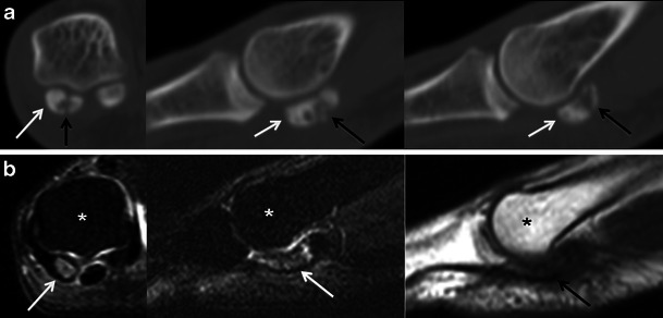 Fig. 11