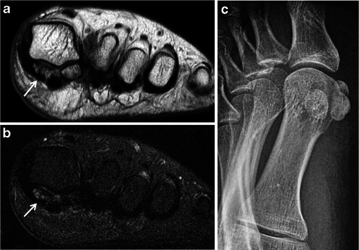 Fig. 10