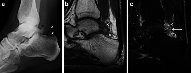 Fig. 17