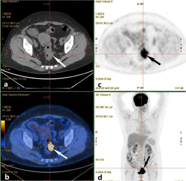 Fig. 2