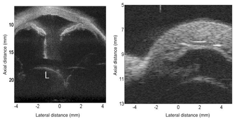 Figure 16